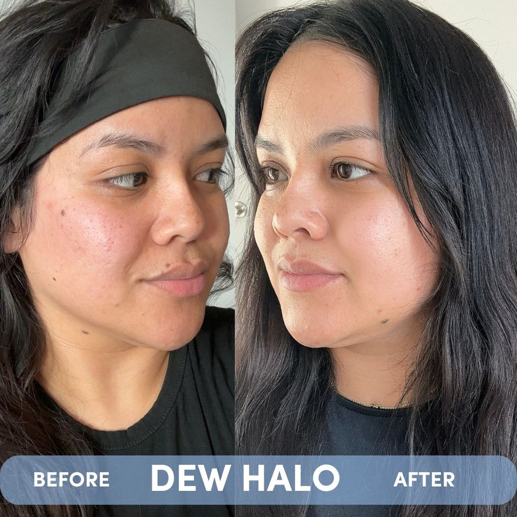 DEW HALO