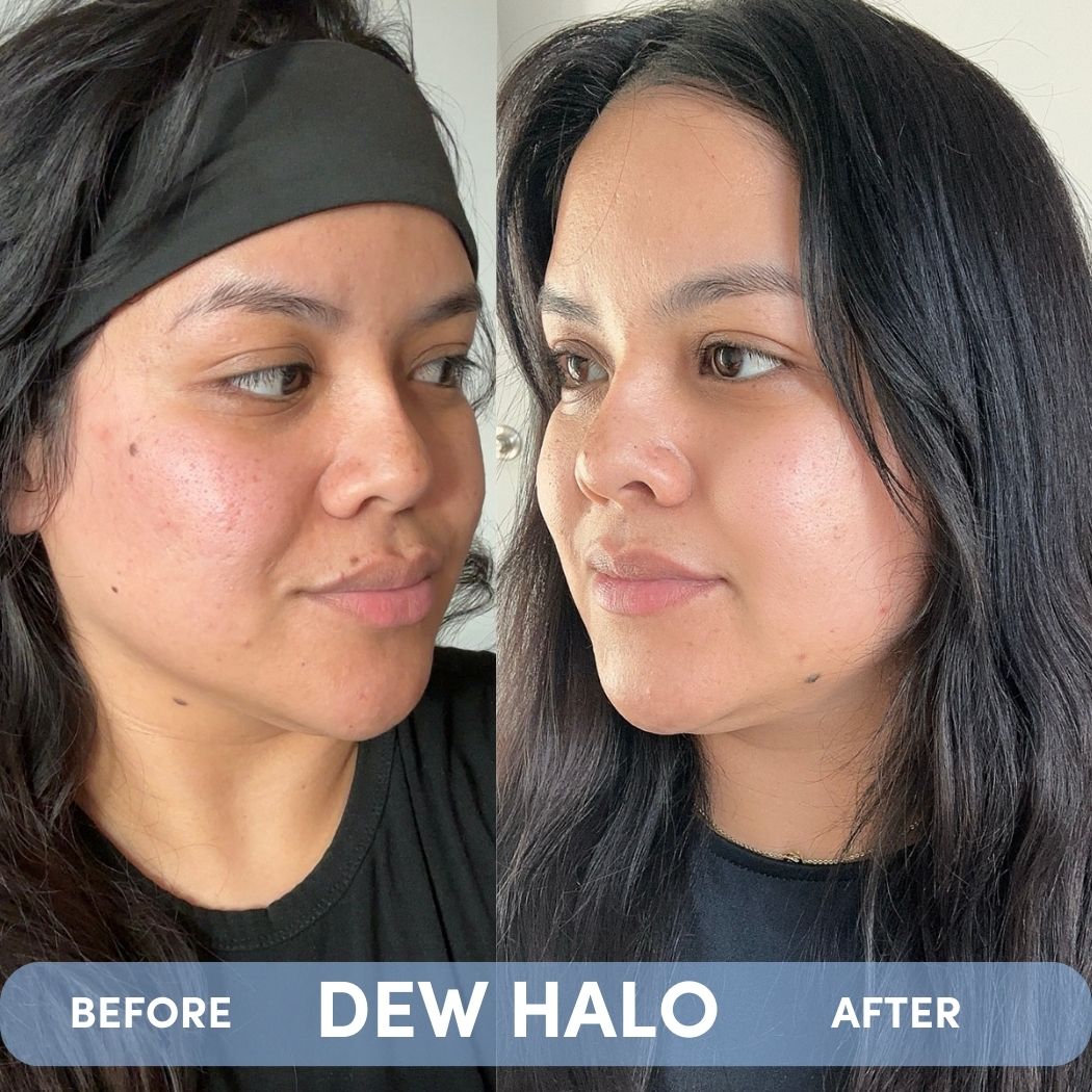 DEW HALO